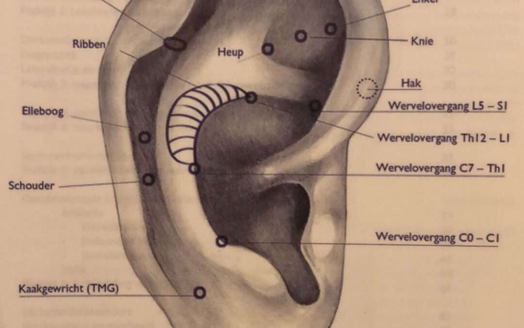 Auriculotherapie Deel 1 | Ooracupunctuur bij Acupunctuur Denise Sour