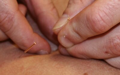 Maak kennis met acupunctuur en Denise Sour