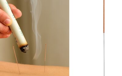 Hoe kan acupunctuur helpen in combinatie met Moxa?