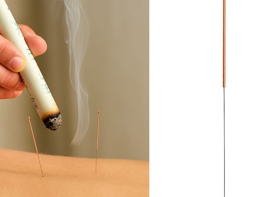 Hoe kan acupunctuur helpen in combinatie met Moxa?